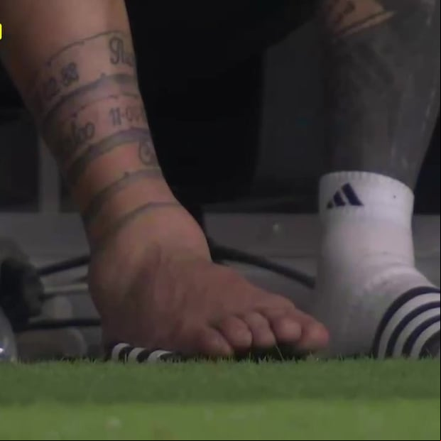 El tobillo de Messi tras la final de la Copa América. (X)