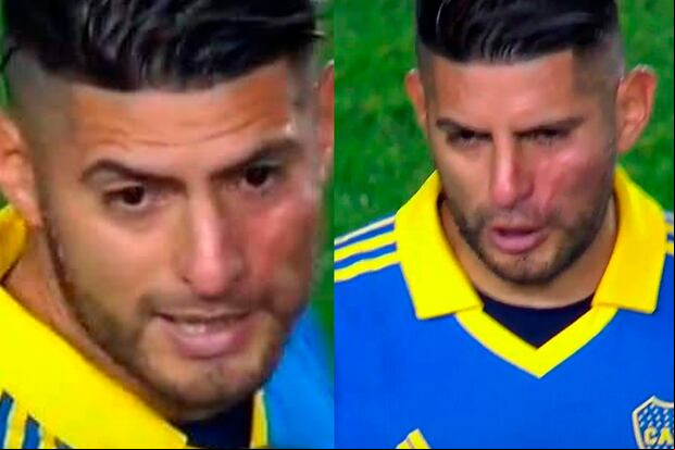 ¿Cómo le quedó la cara a Carlos Zambrano tras pelea con Benedetto?